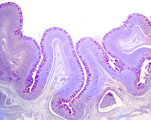 Cosa prendere per far rifiorire la flora intestinale Cosa prendere per far rifiorire la flora intestinale