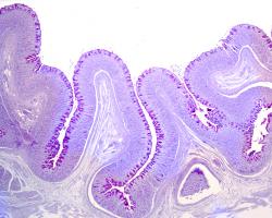 Cosa prendere per far rifiorire la flora intestinale